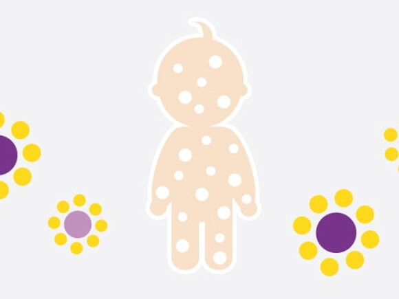 Le rôle des protéines dans la prévention des allergies de bébé