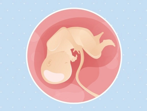 Fœtus 34ème semaine de grossesse 36 sa