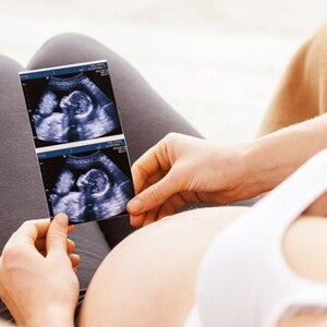 echographie dans les mains d'une femme echographie dans les mains d'une femme