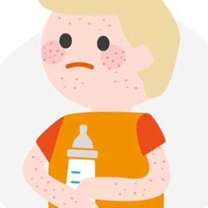 Allergie aux protéines de lait de vache