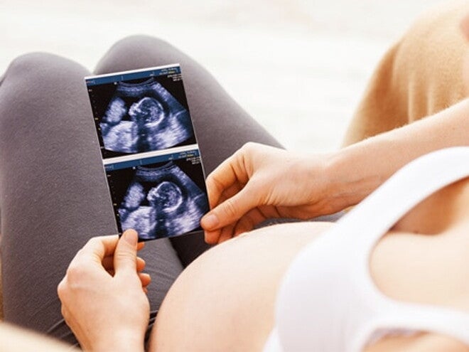 echographie dans les mains d'une femme