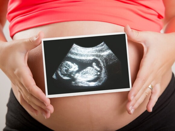 femme tenant une échographie devant son ventre