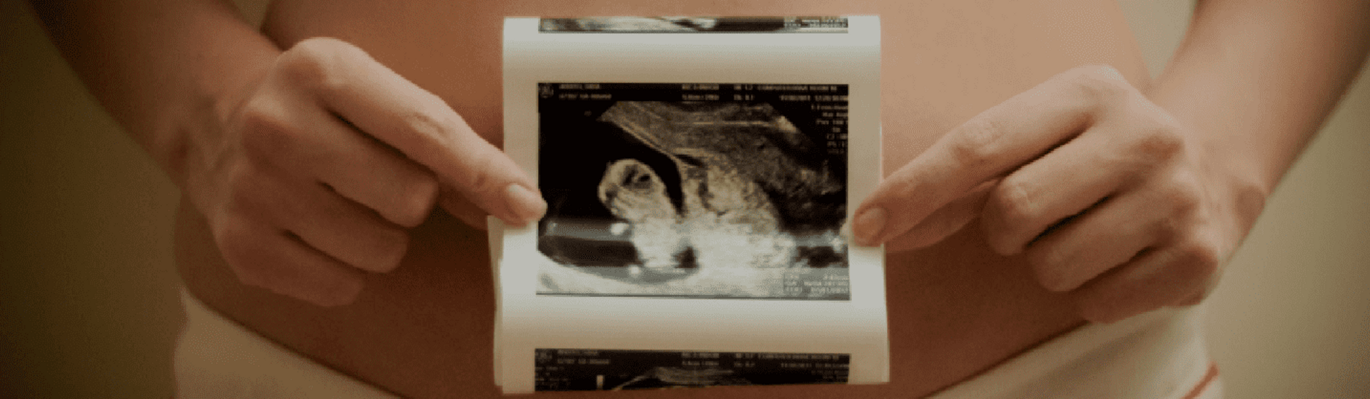 Développement du foetus Développement du foetus